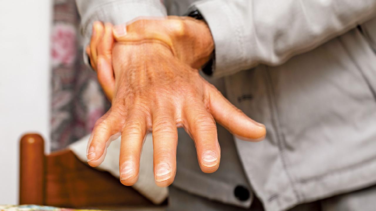 中大發現 腸道微生態失衡為柏金遜症元兇 將來有望可預防