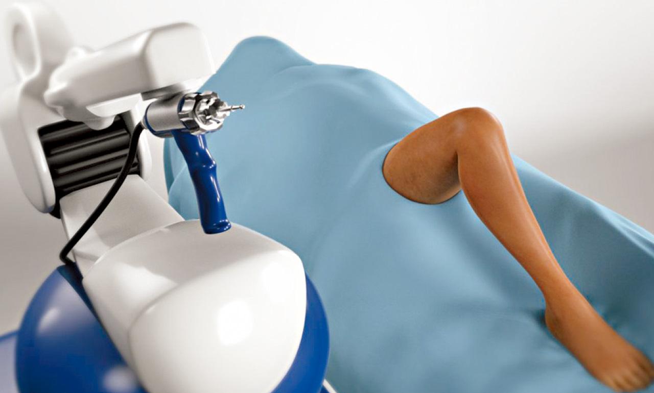 機械臂輔助手術好處多(二) 膝關節置換