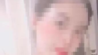 張女花了3.2萬人民幣到「佳禾醫美」診所進行隆鼻手術卻不幸身亡。（微博）