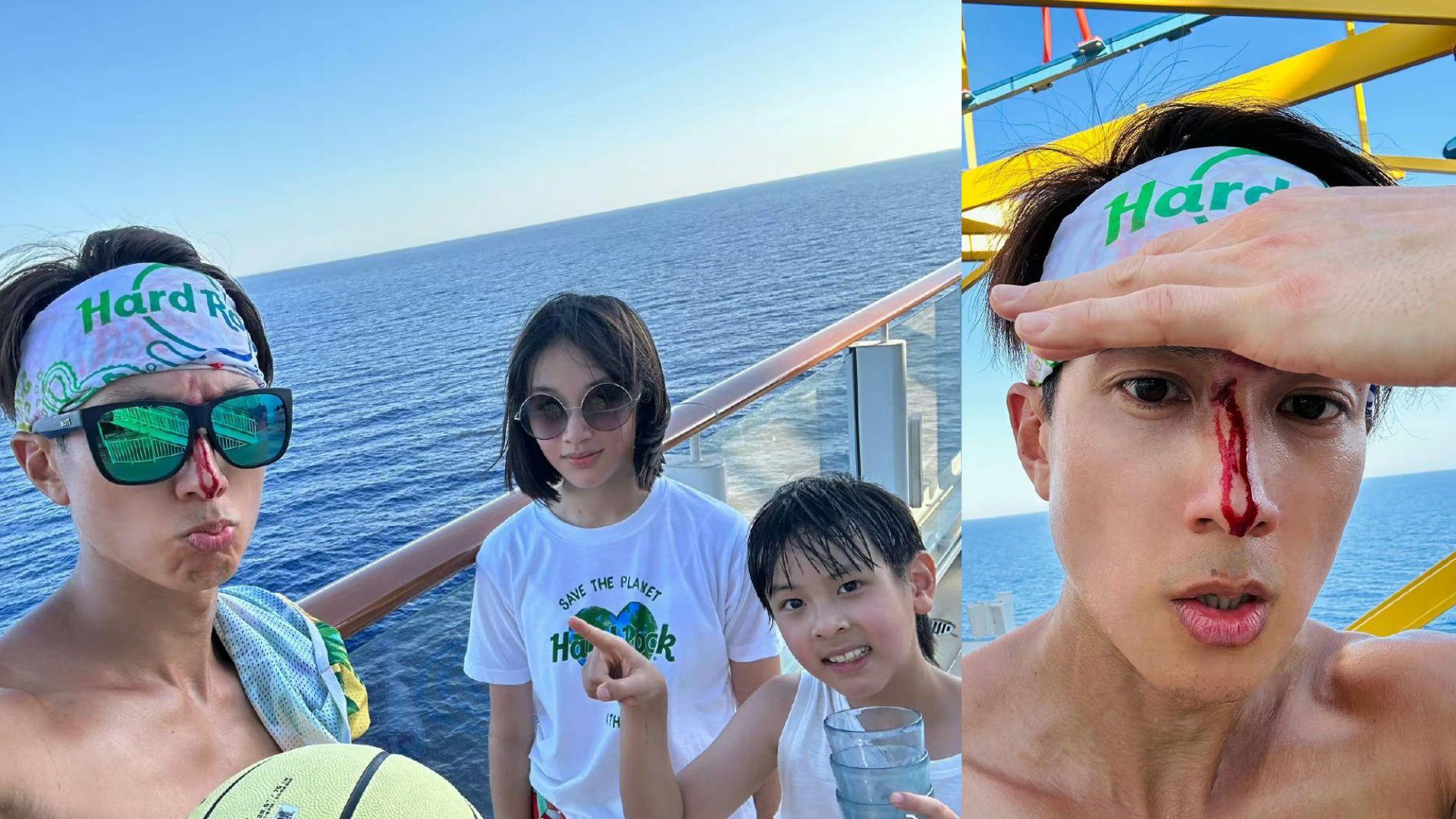 吳尊血流不止不忘自拍 獲6.6萬內地網民讚好