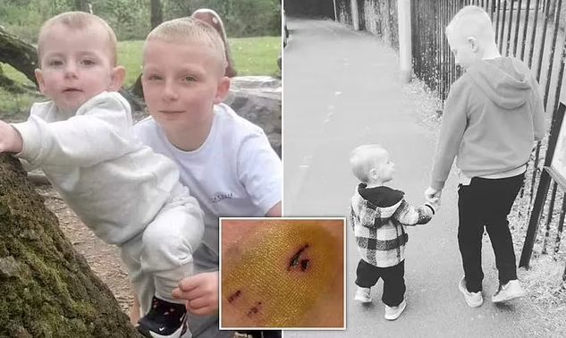 2童男童被鬥牛狗攻擊 命縣一線 10歲哥哥奮不顧身拯救