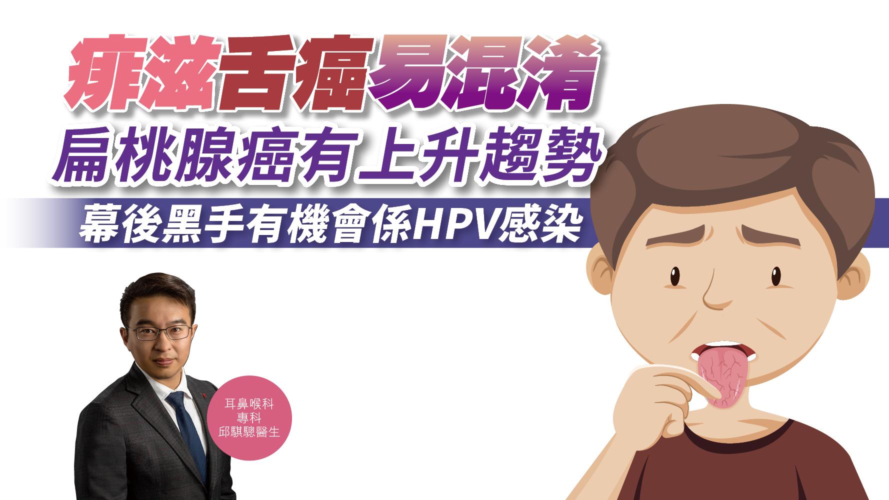 【健康解碼】痱滋舌癌易混淆 扁桃腺癌有上升趨勢 幕後黑手有機會係HPV感染