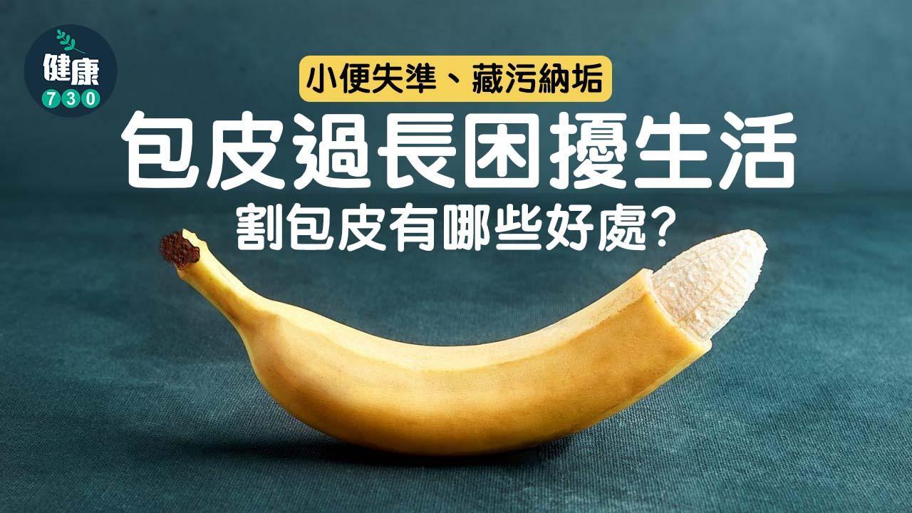 割包皮｜小便失準、藏污納垢？包皮過長困擾生活