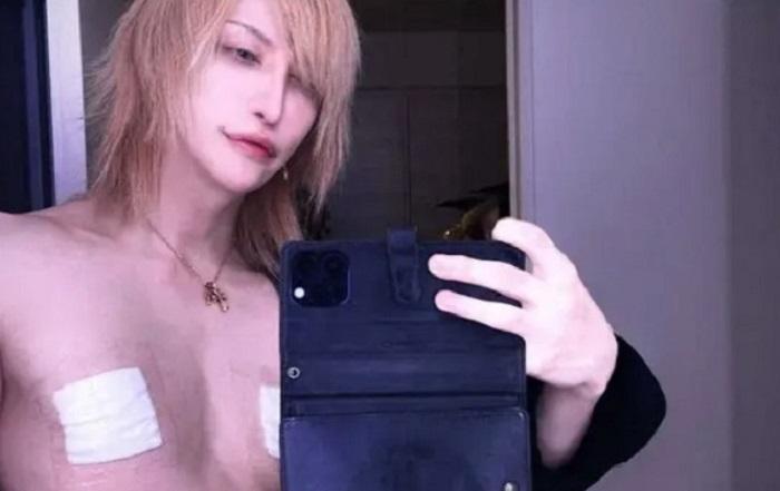 阻演奏好煩惱 日本結他手MiA切除乳頭：可專心彈奏