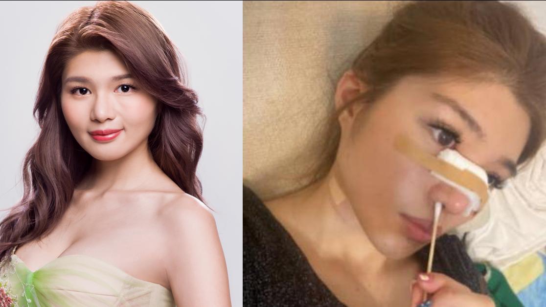 香港小姐2023｜9號潘明璇遭前男友爆黑材料 被指整容虛報學曆 