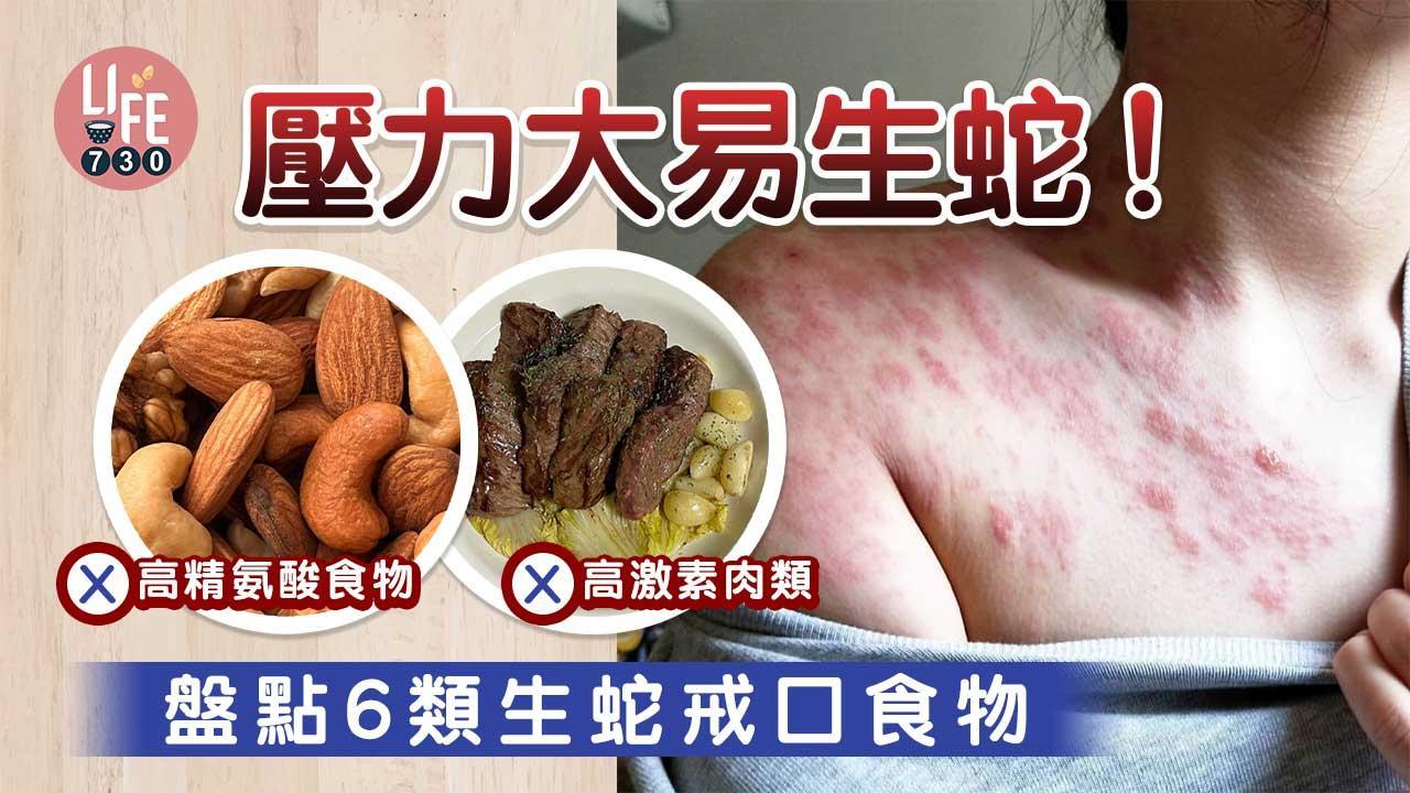 生蛇｜壓力大易成生蛇原因！ 盤點6類生蛇戒口食物 雞肉、牛肉唔食得！