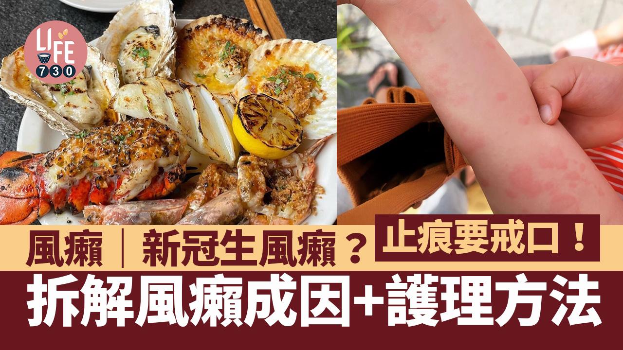 風癩｜新冠生風癩？！拆解風癩成因+護理方法 止痕要戒口！