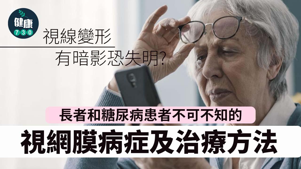 黃斑病變｜視線變形、有暗影恐失明？長者和糖尿病患者不可不知的視網膜病症及治療方法