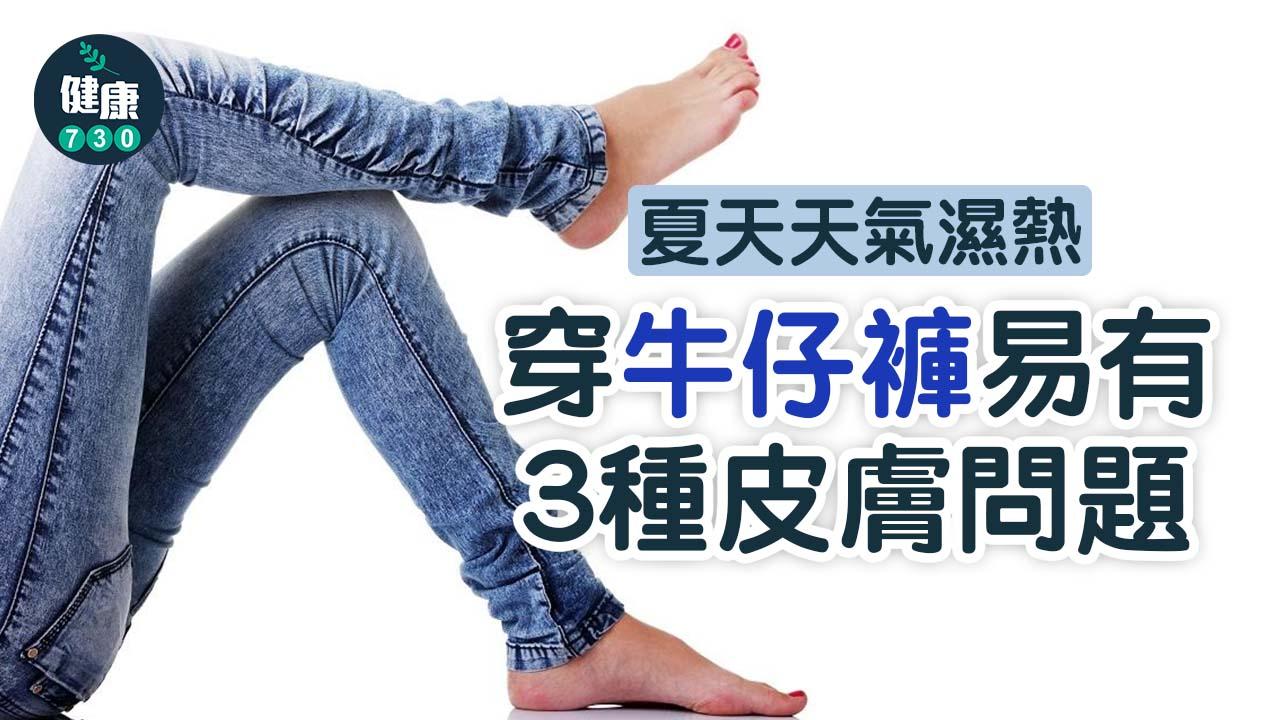 夏天女生很少穿牛仔褲？皮膚科醫生分析有3皮膚疾病風險