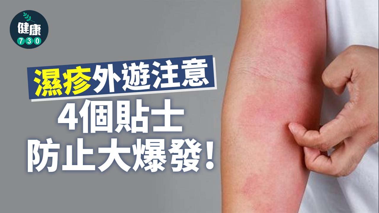 濕疹｜4個止癢方法防止大爆發 旅行控注意！