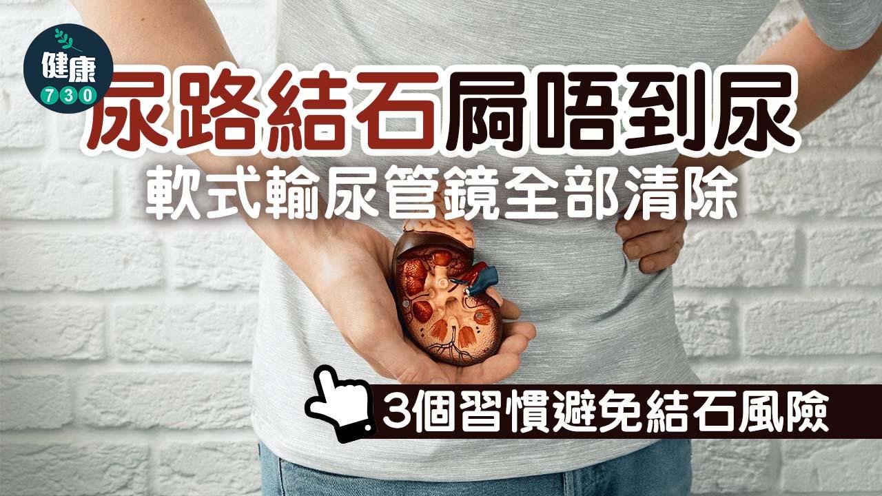 尿路結石屙唔到尿 軟式輸尿管鏡全部清除