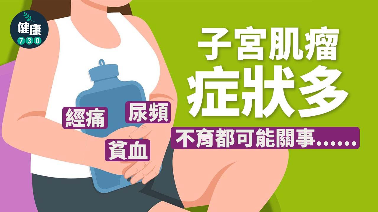 子宮肌瘤症狀多 經痛、尿頻、貧血、不育都可能關事