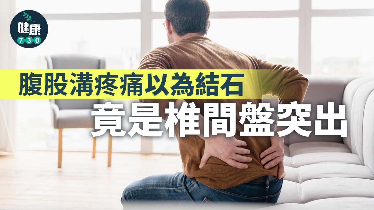 腹股溝疼痛以為結石 竟是椎間盤突出