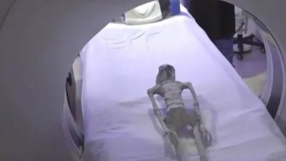 「外星人遺骸」竟是真的？X光驚揭骨架「一體成形」未經人工接駁