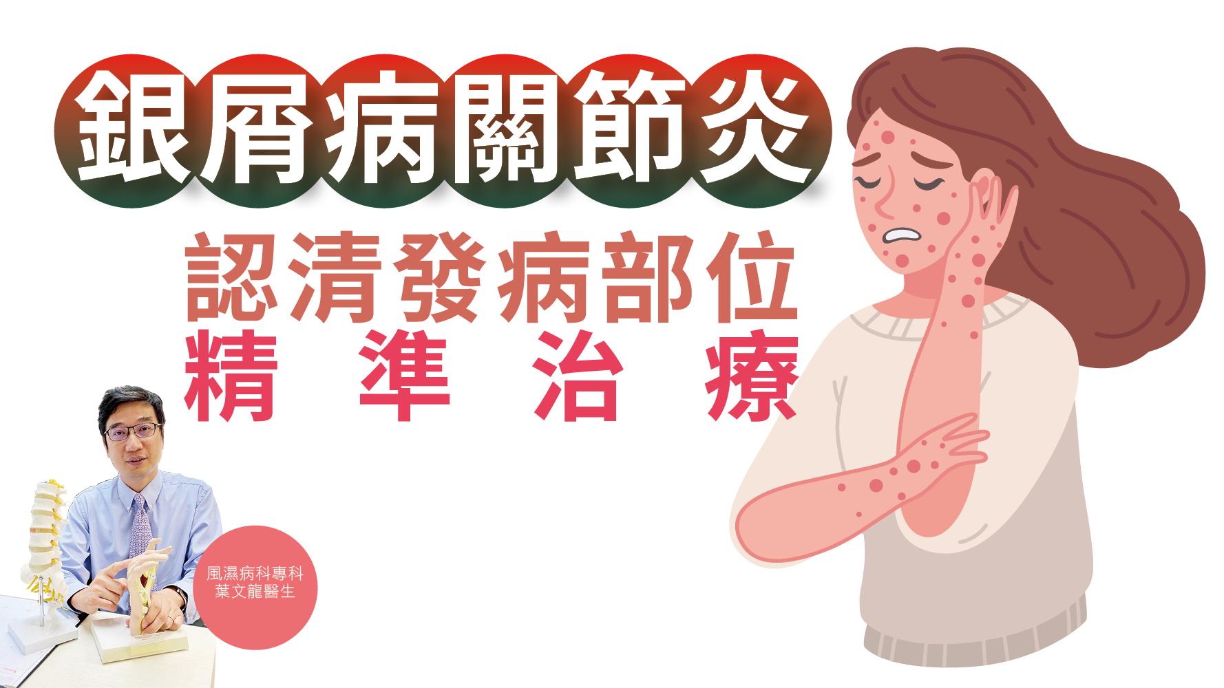 【健康解碼】銀屑病關節炎 認清發病部位 精準治療