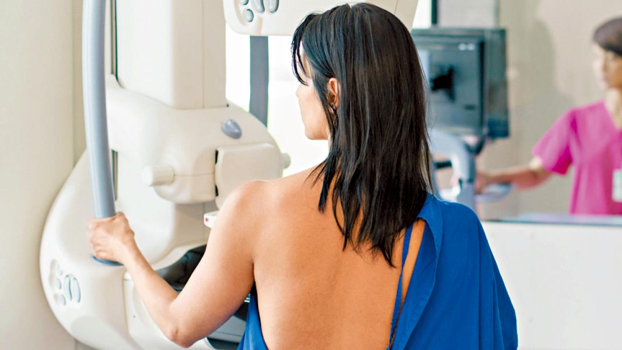 拆解乳癌篩查3大迷思
