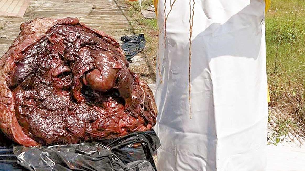 獸醫城中行｜蠕蟲入人腦