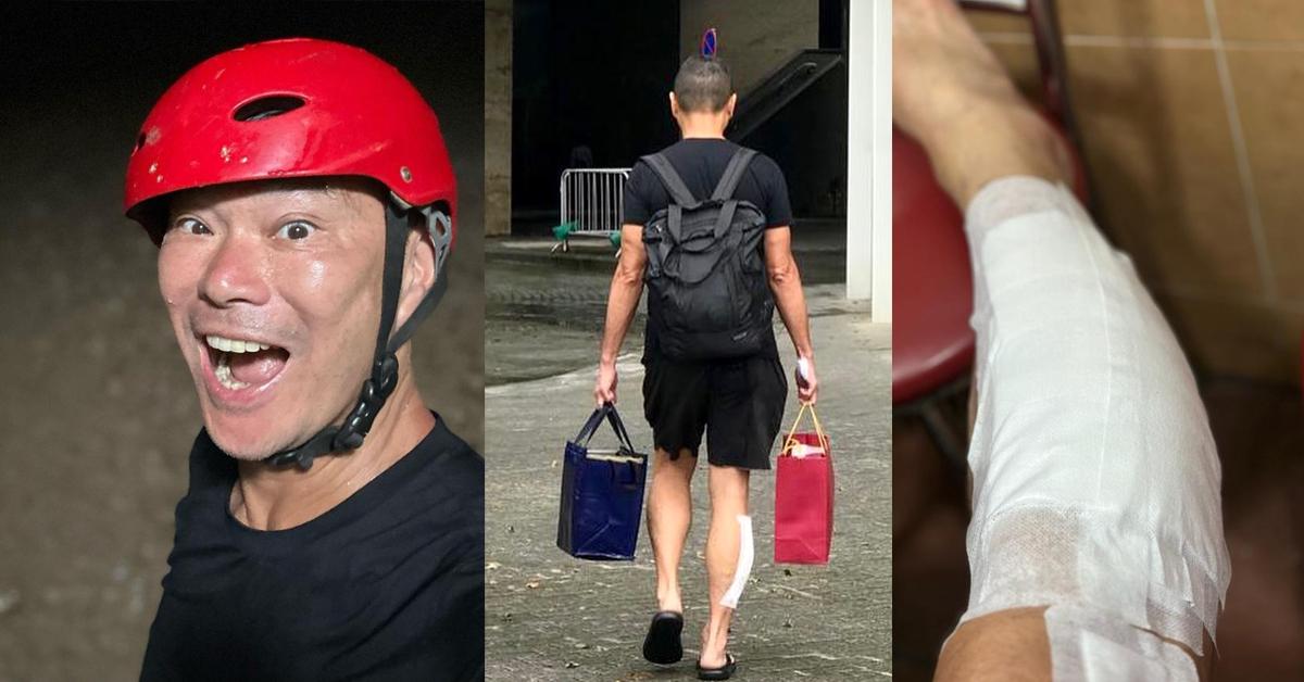 世紀暴雨｜鄧達智自爆被黑雨沖走 右腳 慘磨甩成塊皮