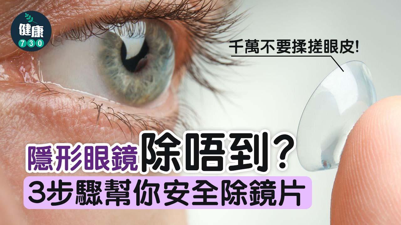 隱形眼鏡｜除唔到con？3步驟幫你改善除con技巧不傷眼（am730製圖）