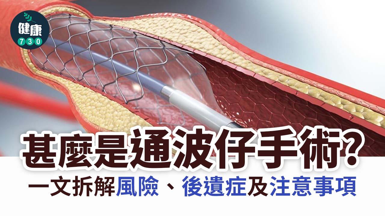 通波仔｜手術後休息幾耐？風險、後遺症及注意事項