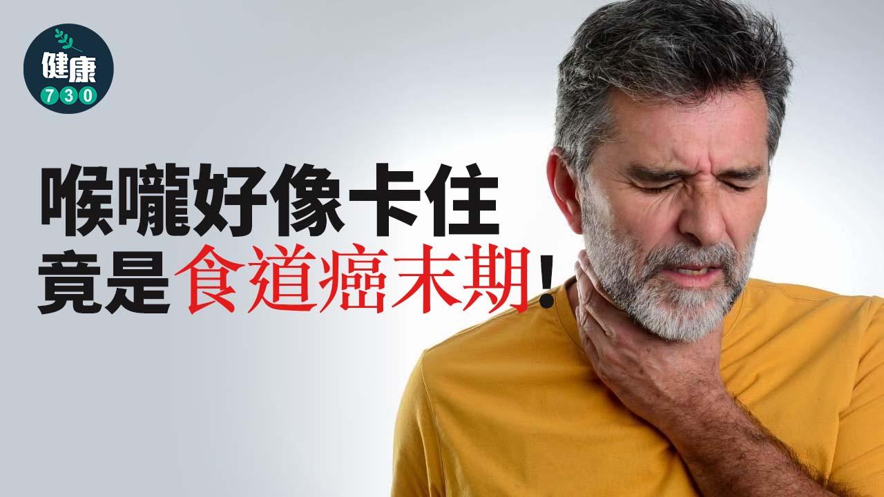 食道癌｜喉嚨好像卡住 竟是食道癌末期！