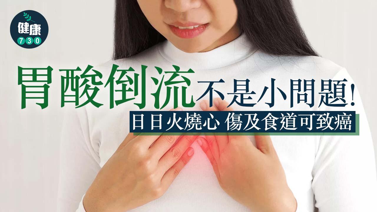 胃酸倒流不是小問題 日日火燒心 傷及食道可致癌！