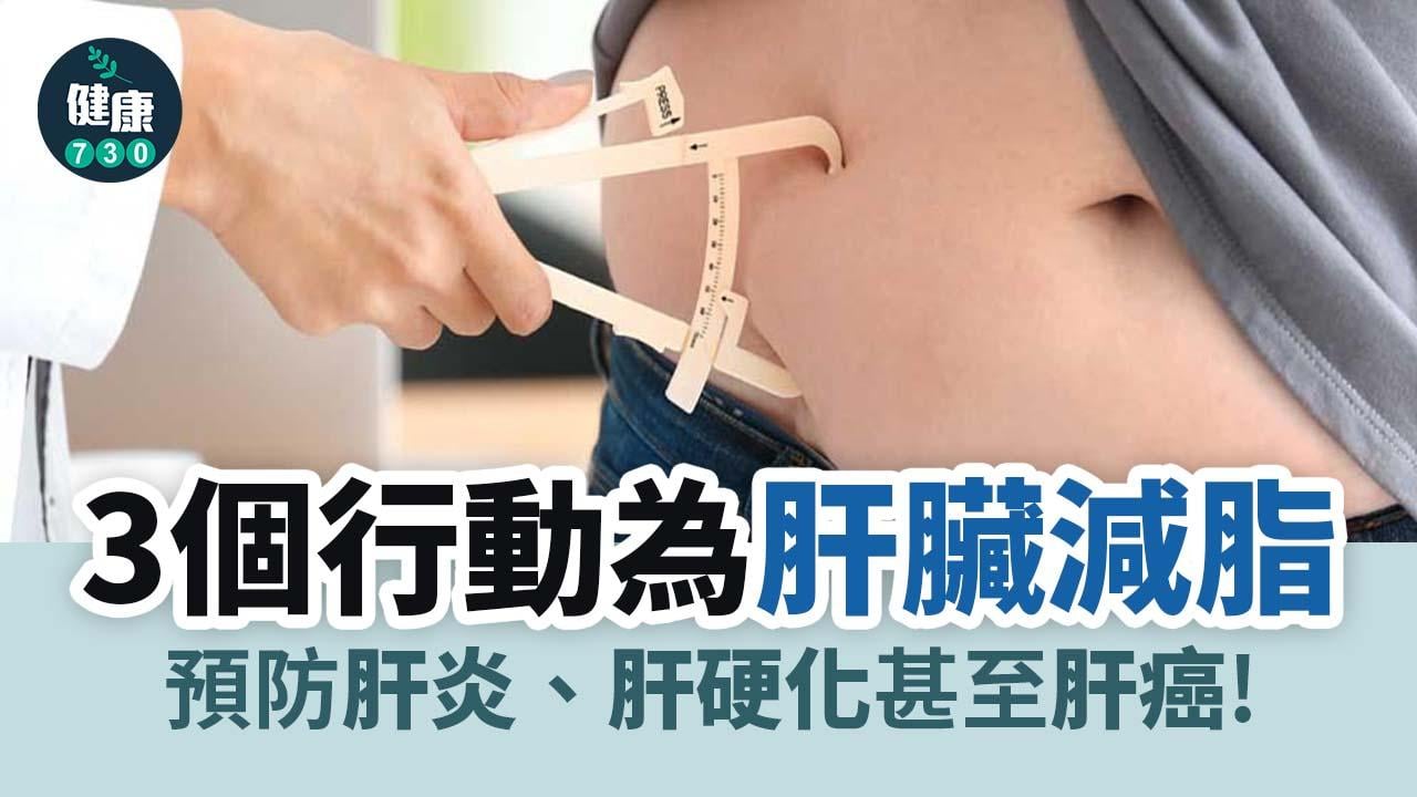 脂肪肝｜3個行動為肝臟減脂 防肝炎癌變保健康