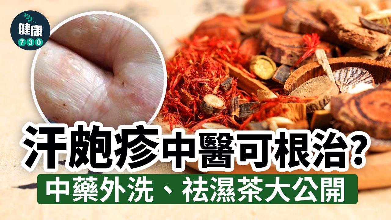 汗皰疹中醫可根治？中藥外洗方大公開