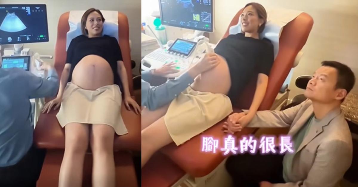 朱慧敏隨時生得 產檢發現BB遺傳媽媽長腿DNA