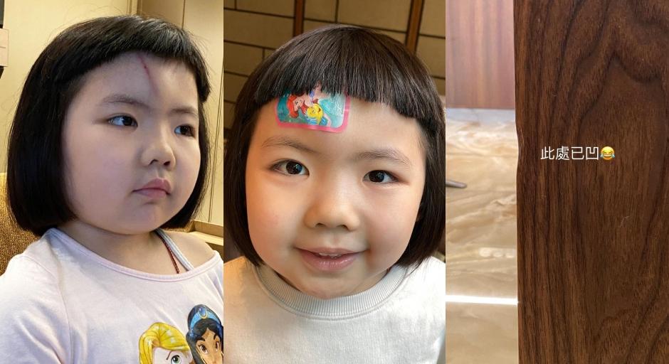 李元元Lucy傷額頭兼撞凹櫃 媽媽被網民狠批：唔知點解家居意外會笑得出