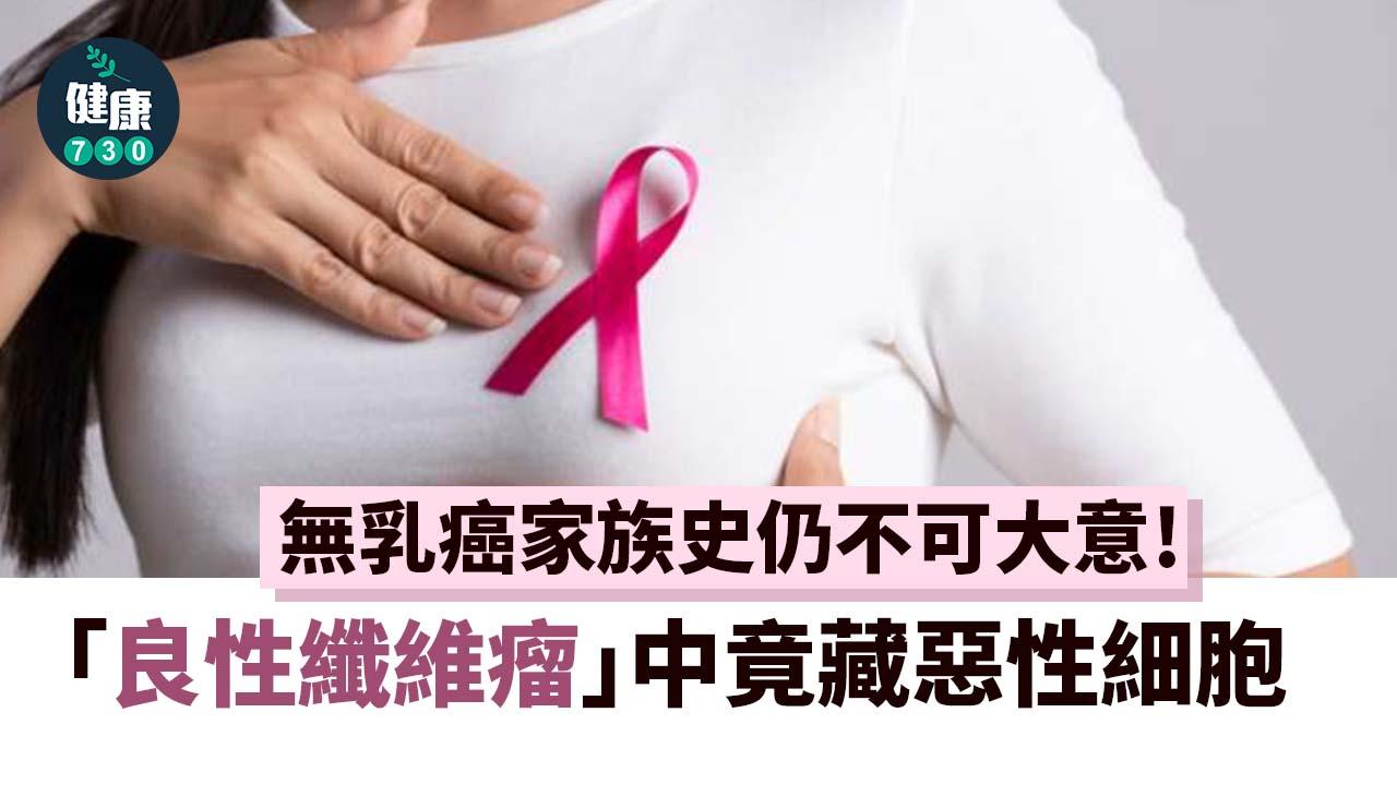 無乳癌家族史仍不可大意！「良性纖維瘤」中竟藏惡性細胞