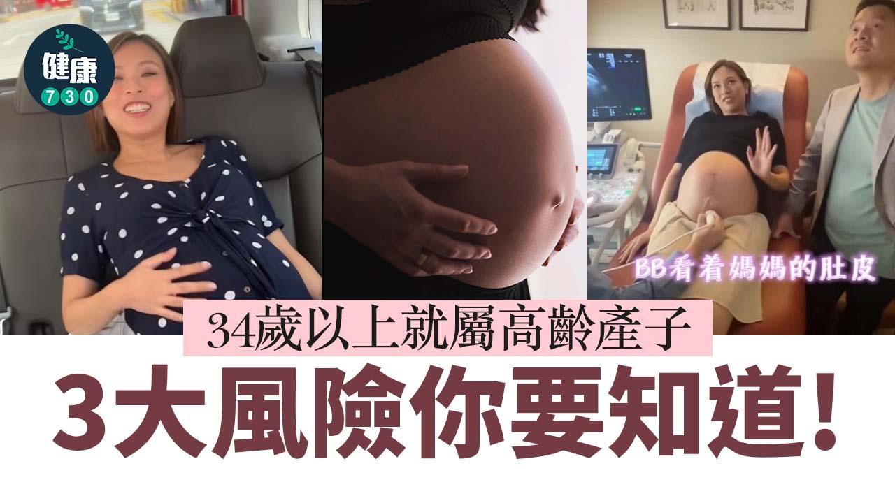 高齡產婦｜34歲以上就屬高齡產子 3大風險你要知道！