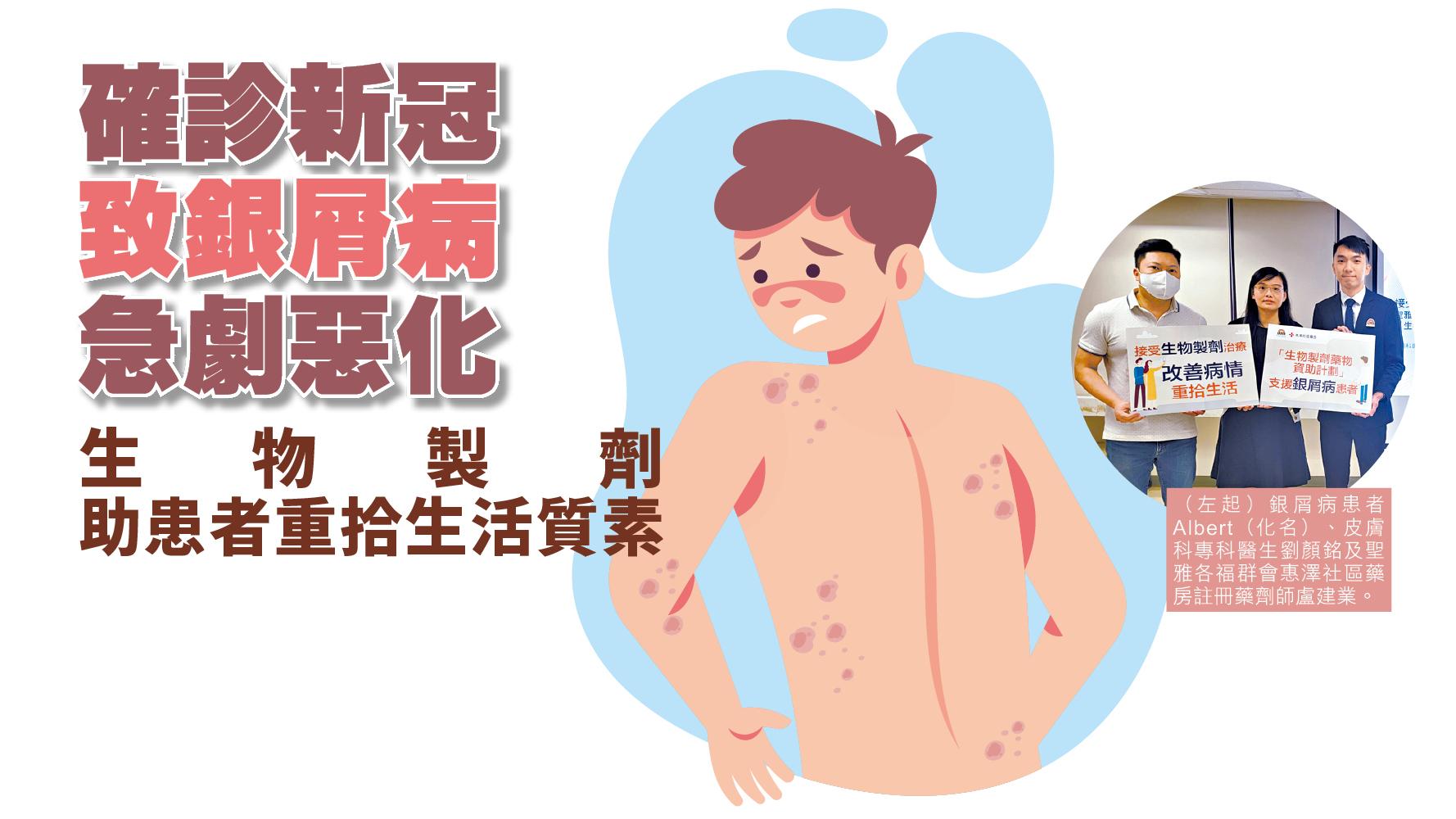 確診新冠致銀屑病急劇惡化 生物製劑助患者重拾生活質素