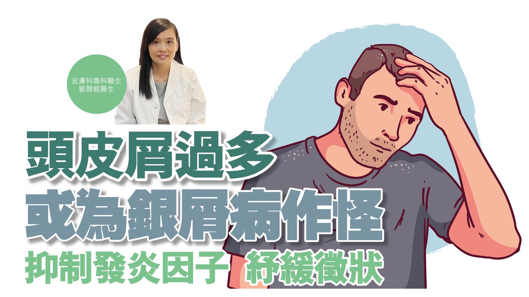 健康解碼｜頭皮屑過多 或為銀屑病作怪 抑制發炎因子 紓緩徵狀