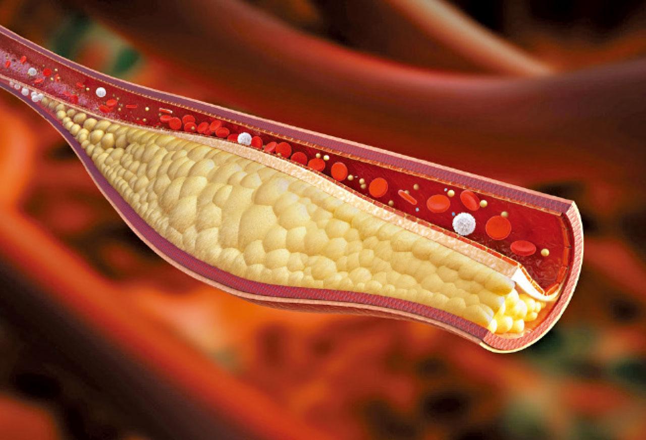 膽固醇控制指標