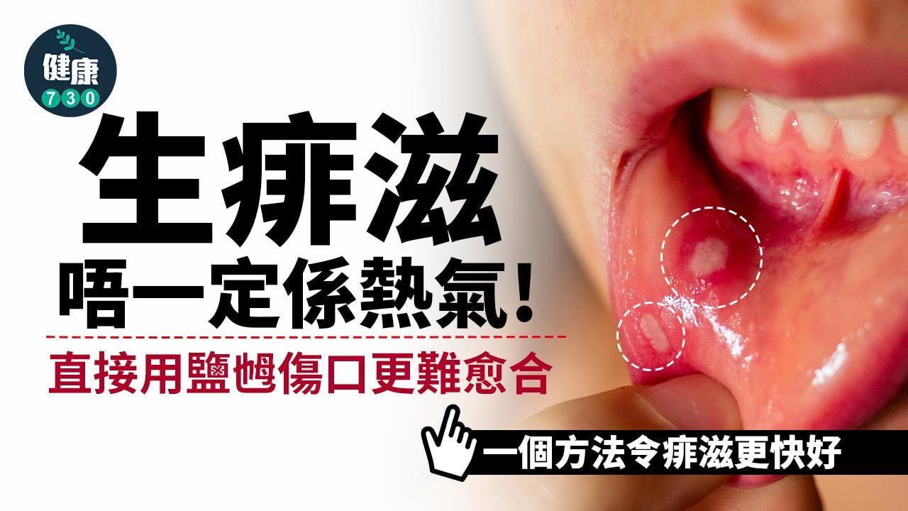 生痱滋原因唔一定係熱氣 用鹽乸原來唔可以？(am730製圖)