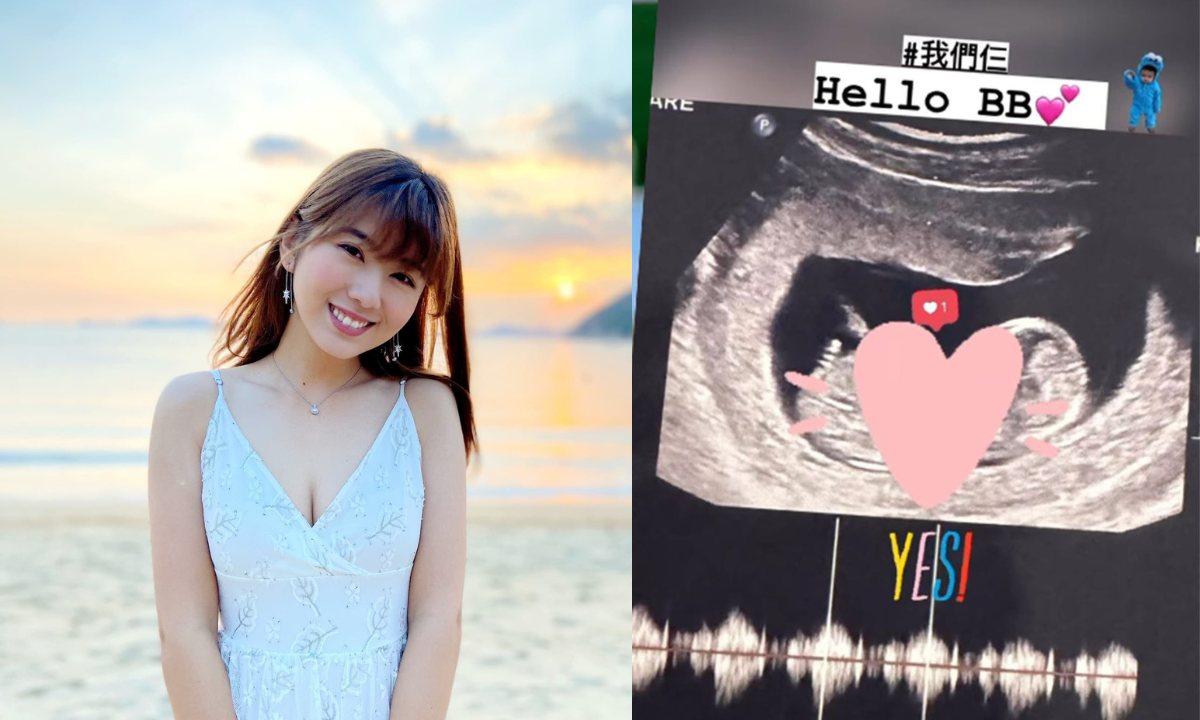 陳嘉慧結婚兩月內宣布懷孕 TVB小花IG晒超聲波照：我們仨