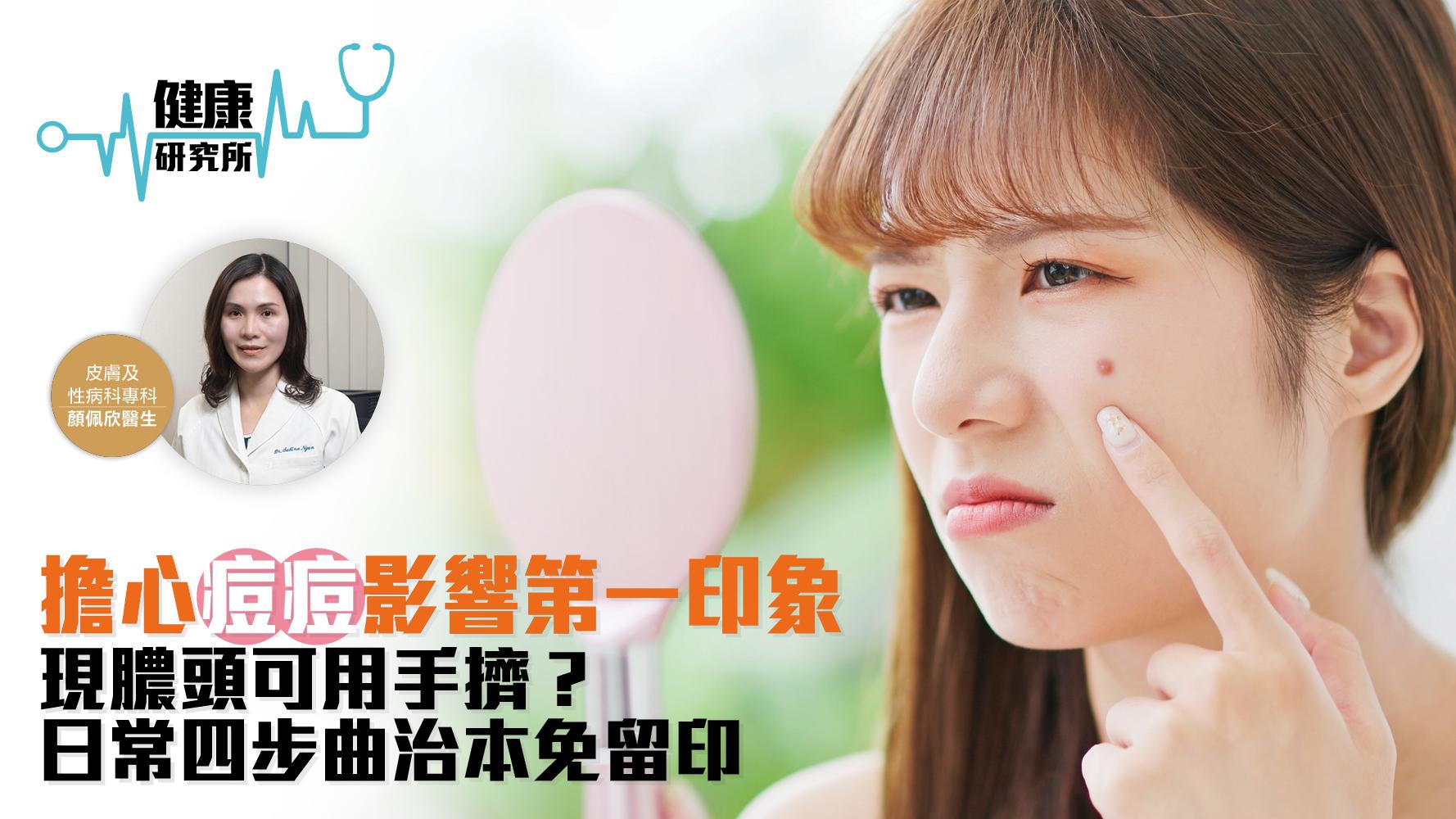 健康研究所｜擔心痘痘影響第一印象 現膿頭可用手擠？日常四步曲治本免留印