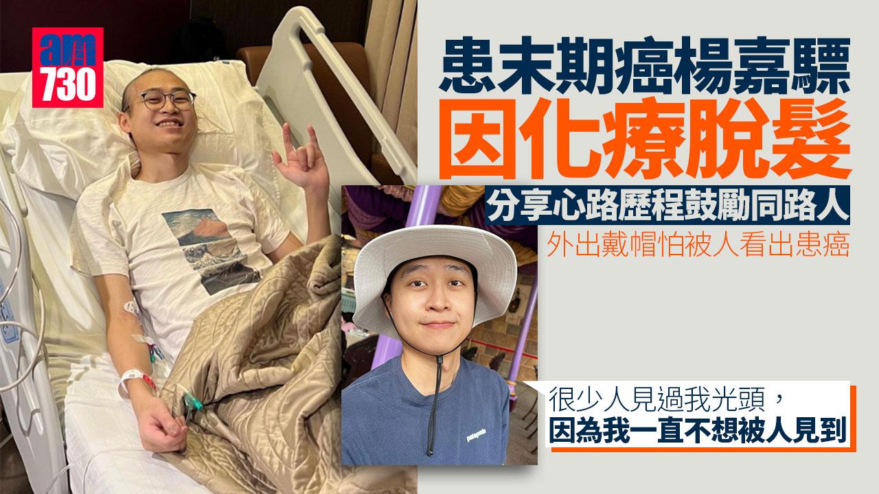 珍惜生命｜患末期癌楊嘉驃公開脫髮照 分享化療經歷鼓勵同路人