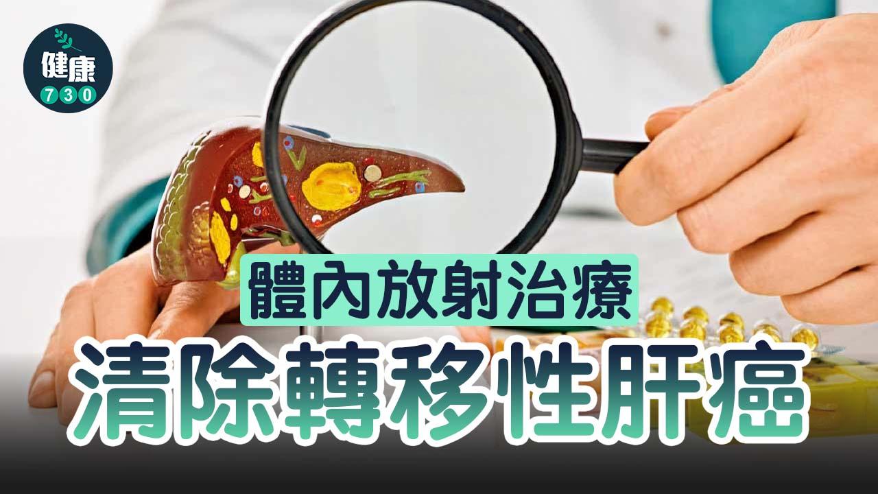 體內放射治療 清除轉移性肝癌