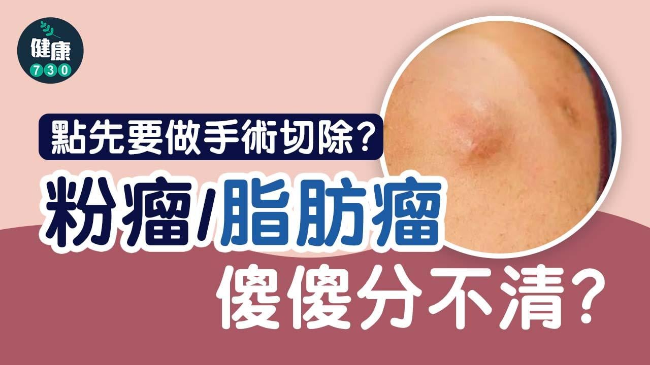 粉瘤、脂肪瘤傻傻分不清？點先要做手術切除？