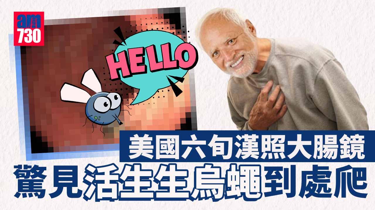 令人崩潰｜六旬漢照大腸鏡　驚見活生生烏蠅到處爬