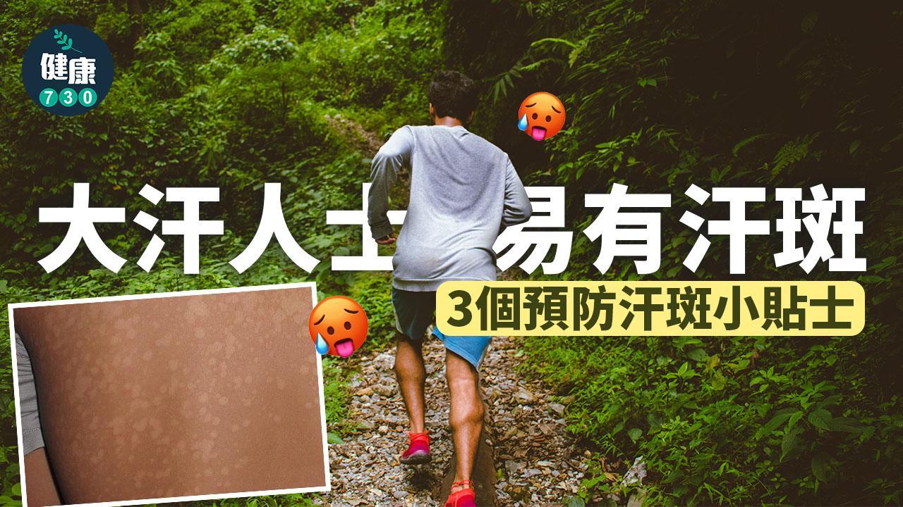 汗斑原因｜大汗人士易有的皮膚病 運動後換衫可預防(附預防汗斑小貼士)（am730製圖）