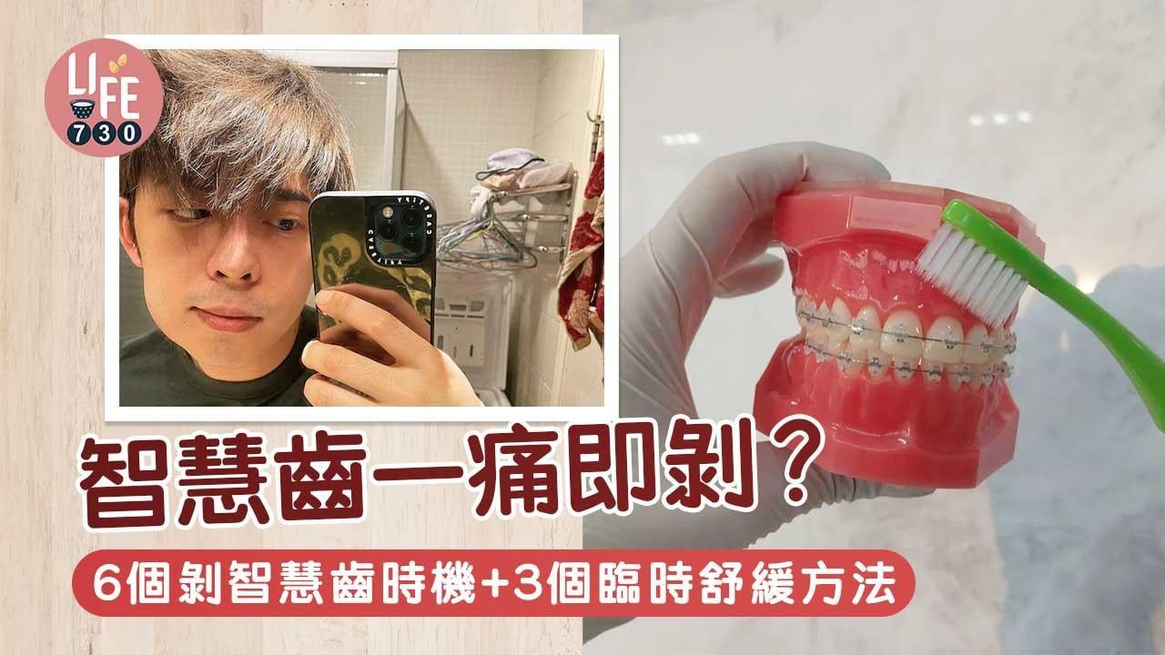 智慧齒一痛即剝？！6個剝智慧齒時機+3個臨時舒緩方法（am730製圖）