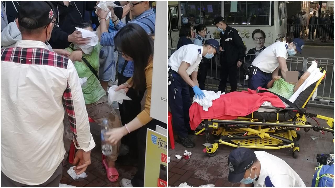元朗擺地攤女子遭潑腐液捱斬，受傷送院。(唔係《食在元朗》@FB)