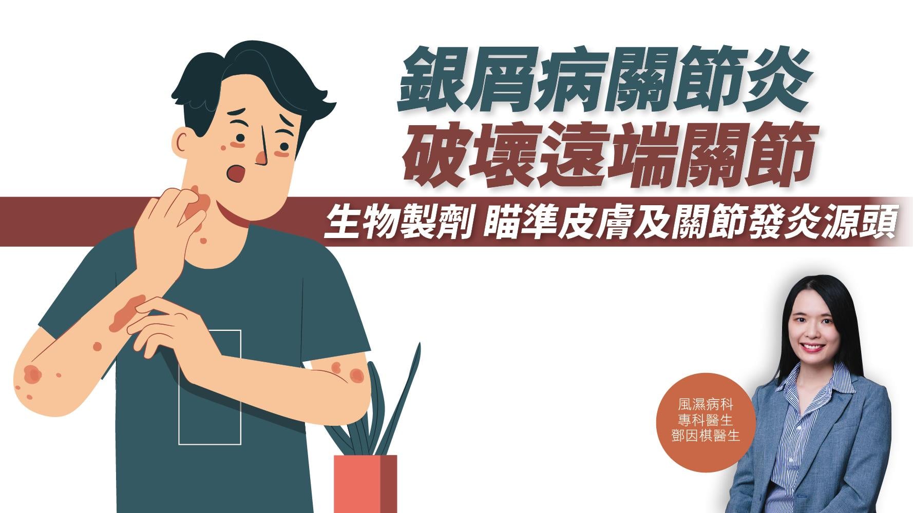 健康解碼｜銀屑病關節炎 破壞遠端關節 生物製劑 瞄準皮膚及關節發炎源頭