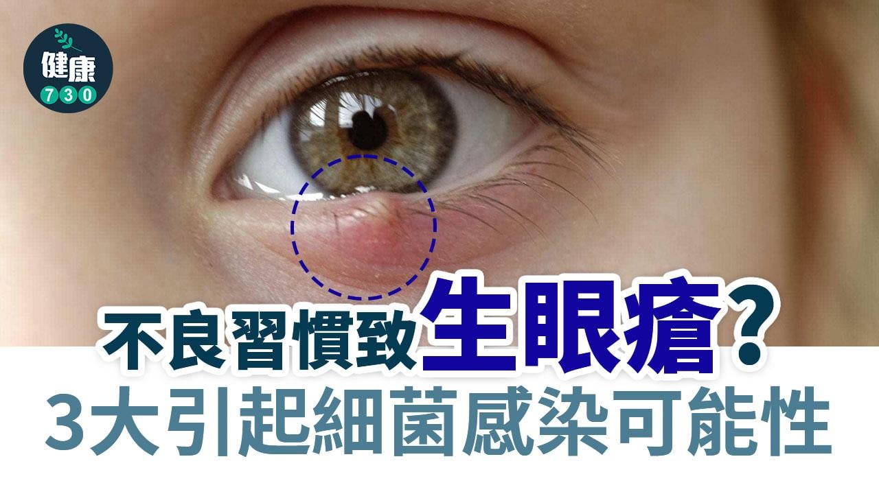 眼挑針成因｜不良習慣致生眼瘡？3大引起細菌感染可能性