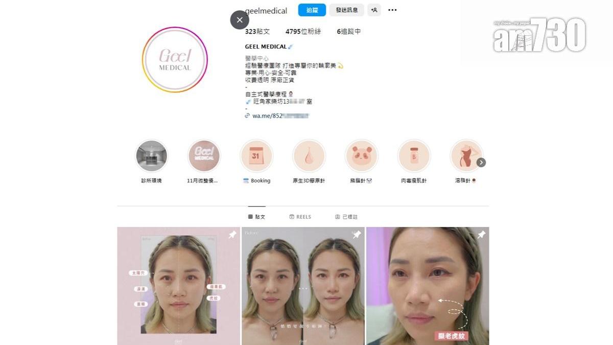 顧客感染膿腫分枝桿菌　「GEEL MEDICAL」續營業指療程無問題