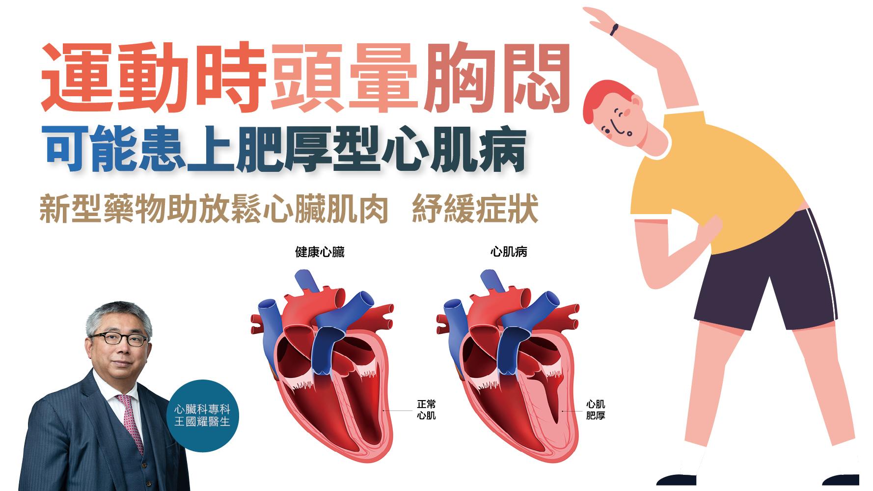 健康解碼｜運動時頭暈胸悶 可能患上肥厚型心肌病 新型藥物助放鬆心臟肌肉 紓緩症狀
