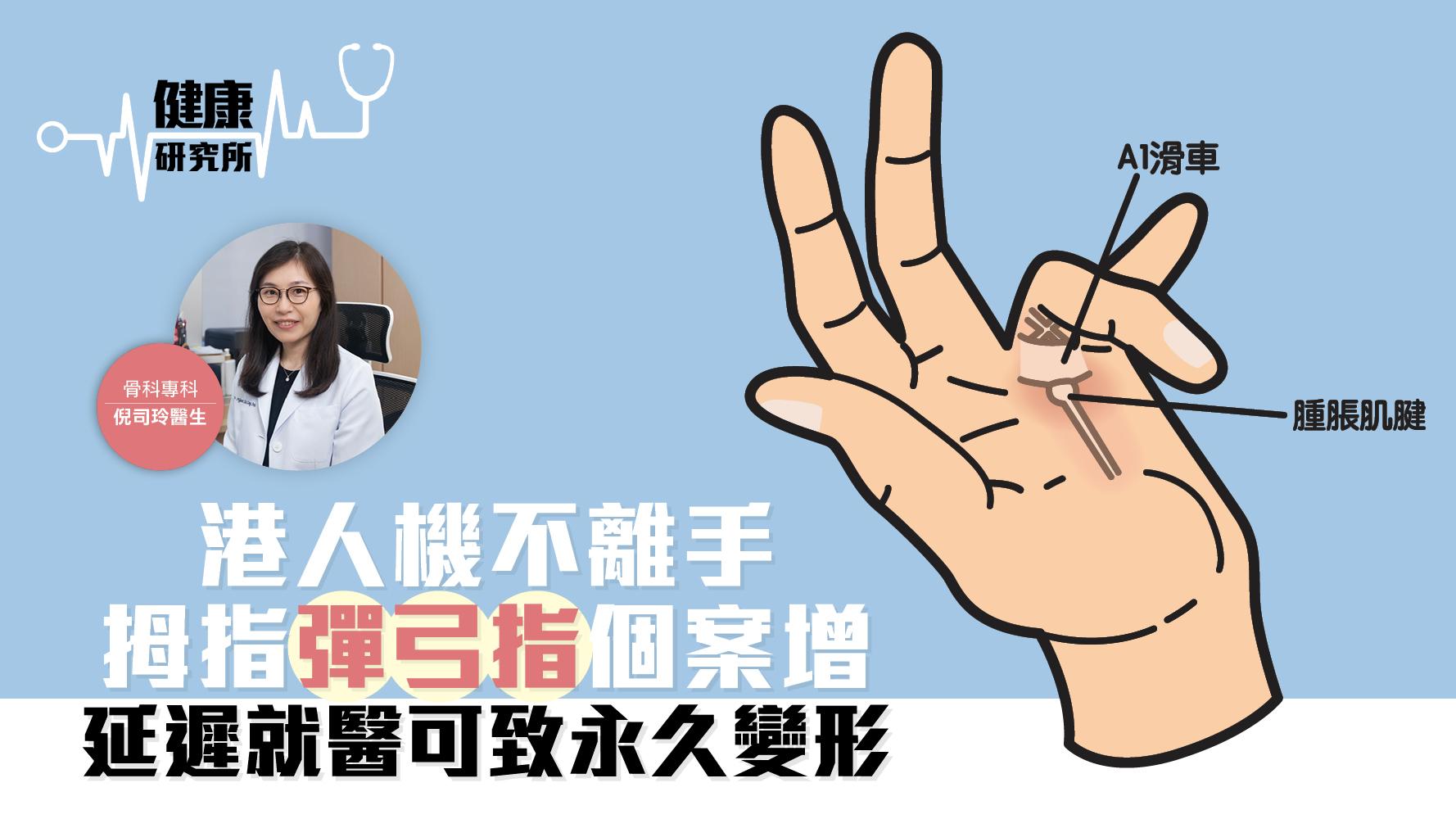 健康研究所｜港人機不離手 拇指「彈弓指」個案增 延遲就醫可致永久變形